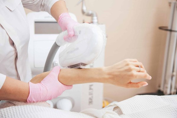 Épilation définitive à haute fréquence : une peau sans poils innovante